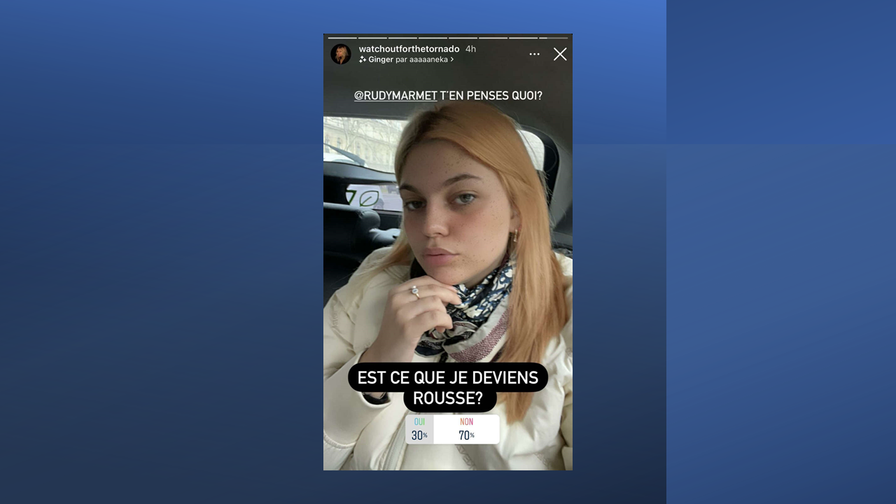 Louane innove en interrogeant ses fans sur une éventuelle nouvelle couleur de cheveux