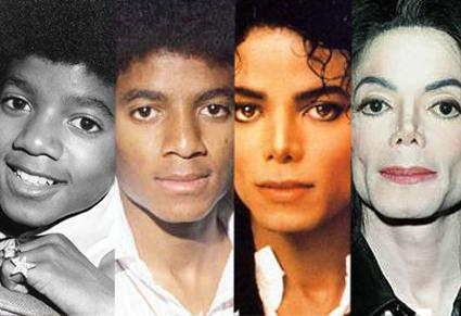 michael Jackson vitiligo