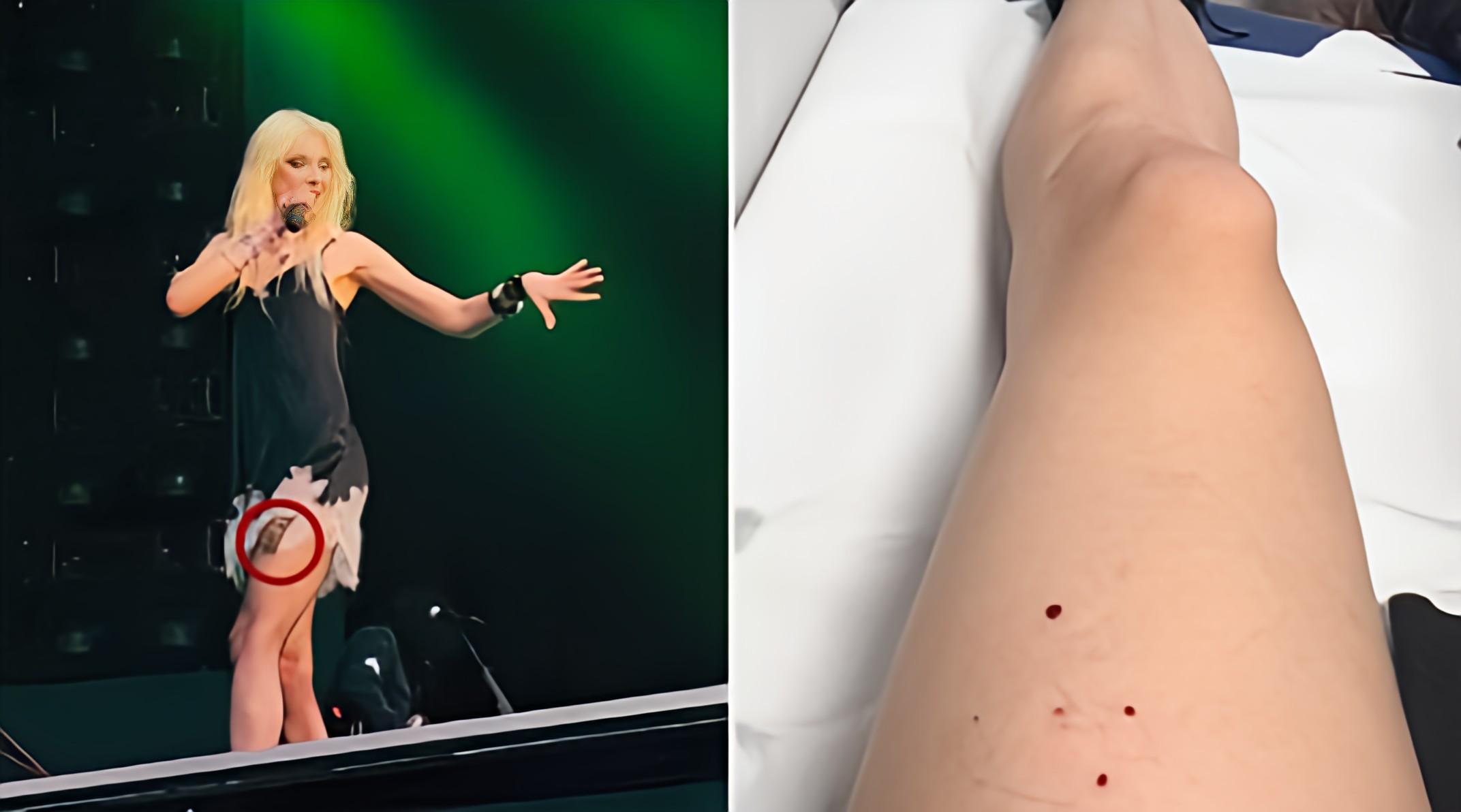 En plein concert, la chanteuse Taylor Momsen, qui chantait en première partie de AC/DC, a été mordue par une chauve-souris.